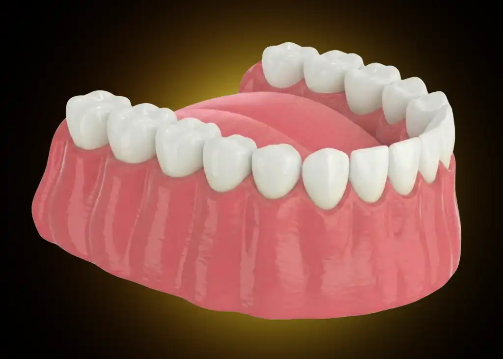 Aligned Smile Braces