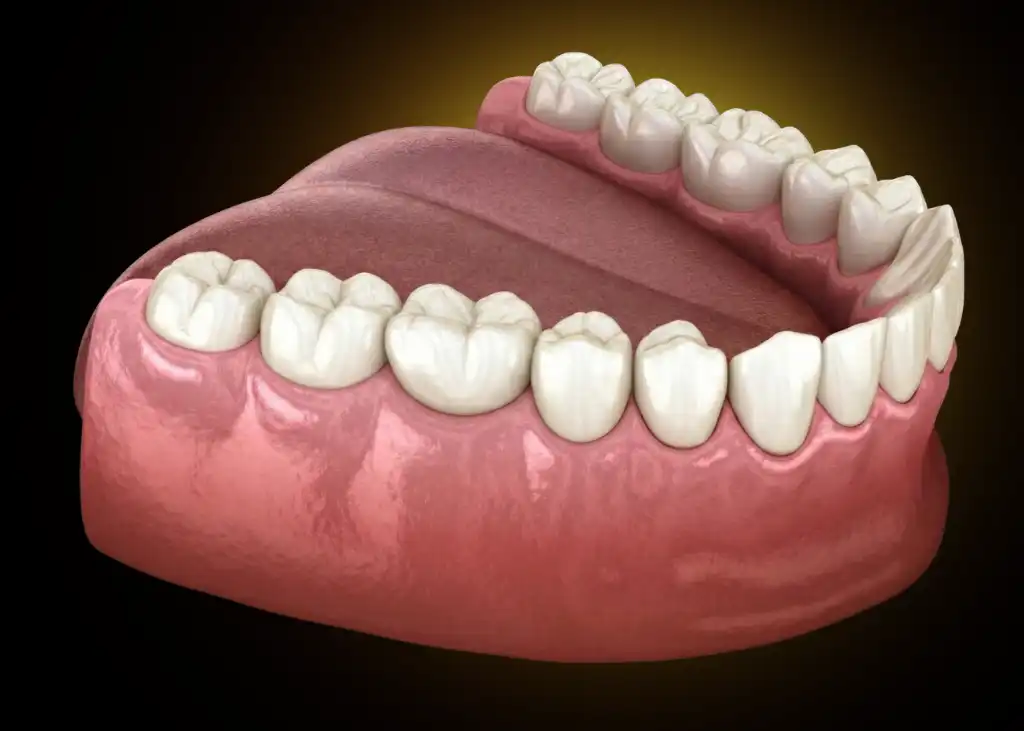 Dental Crown Restoration