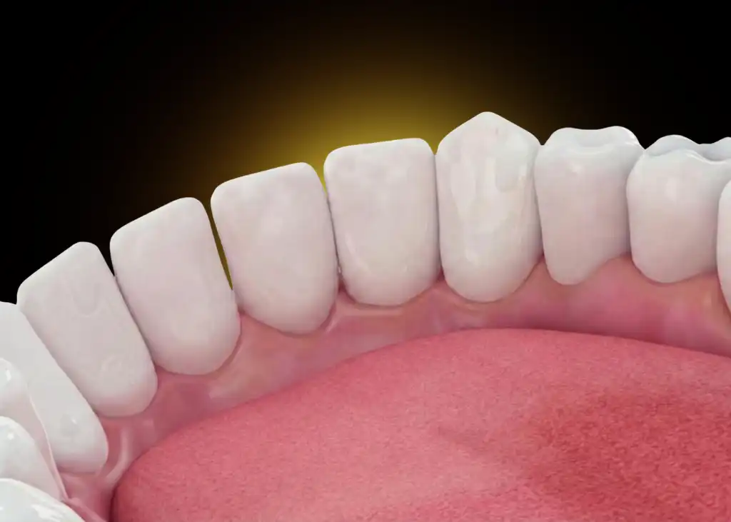 Clean Teeth Scaling